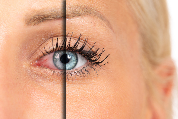 | Andover & Winfield Family Optometry