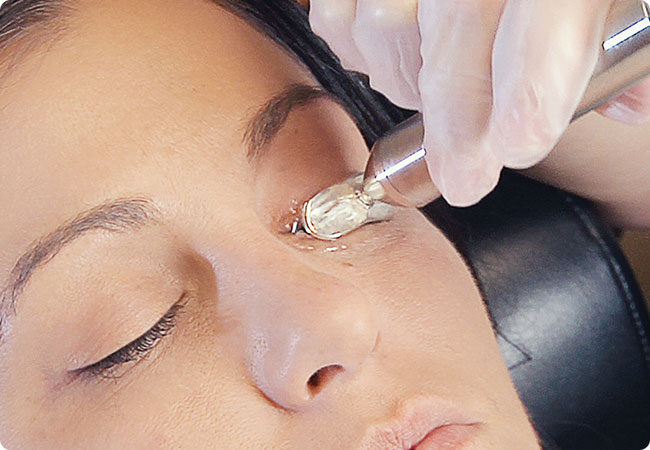 step 1 | Andover & Winfield Family Optometry